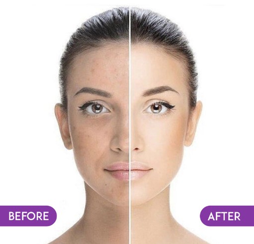 BB Glow Treatment
